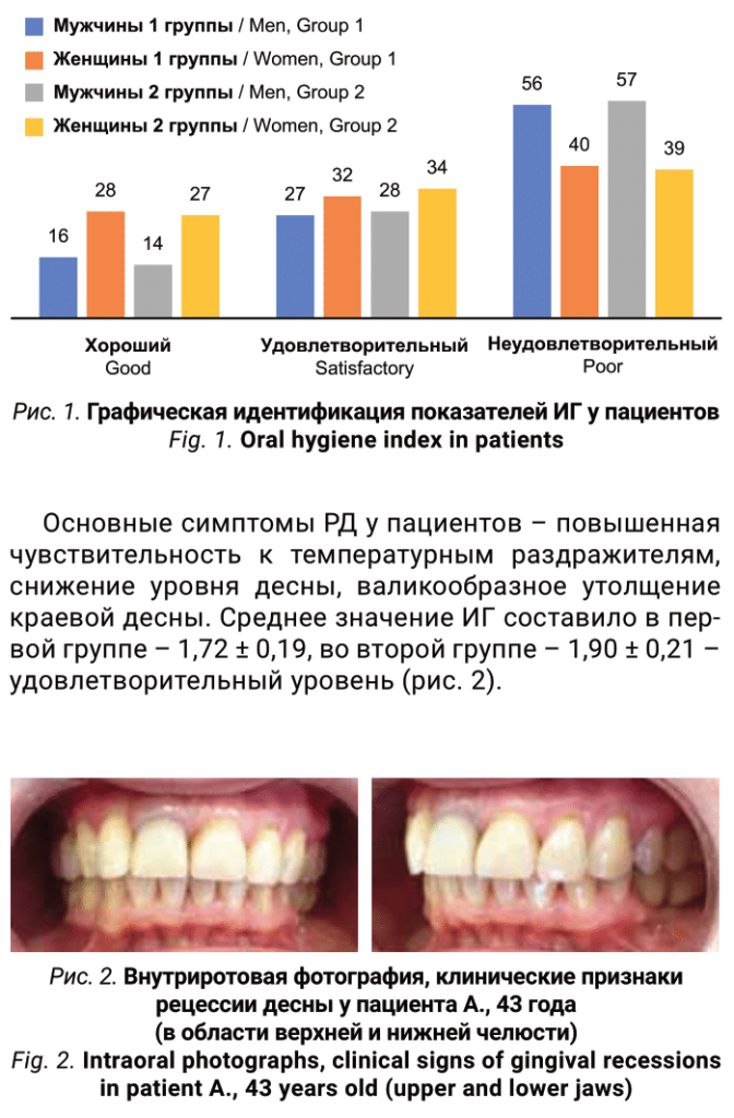 Факторы риска рецессии десны-3.png
